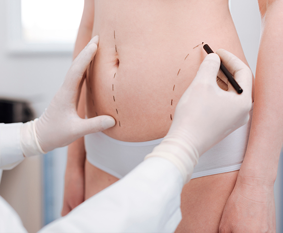 Removed fat from liposuction can also be processed and placed in areas that may need it!