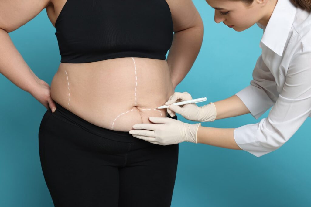 Top professional treatments for a postpartum belly.