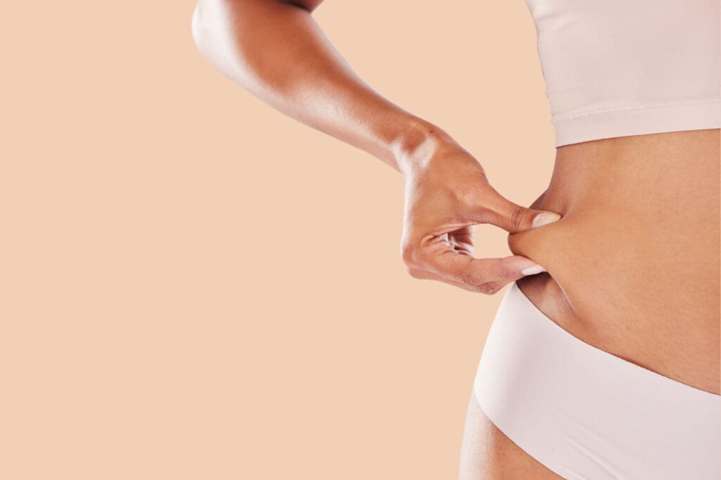 Liposuction is best for adults within 30% of their ideal weight, in good health, and with firm, elastic skin.