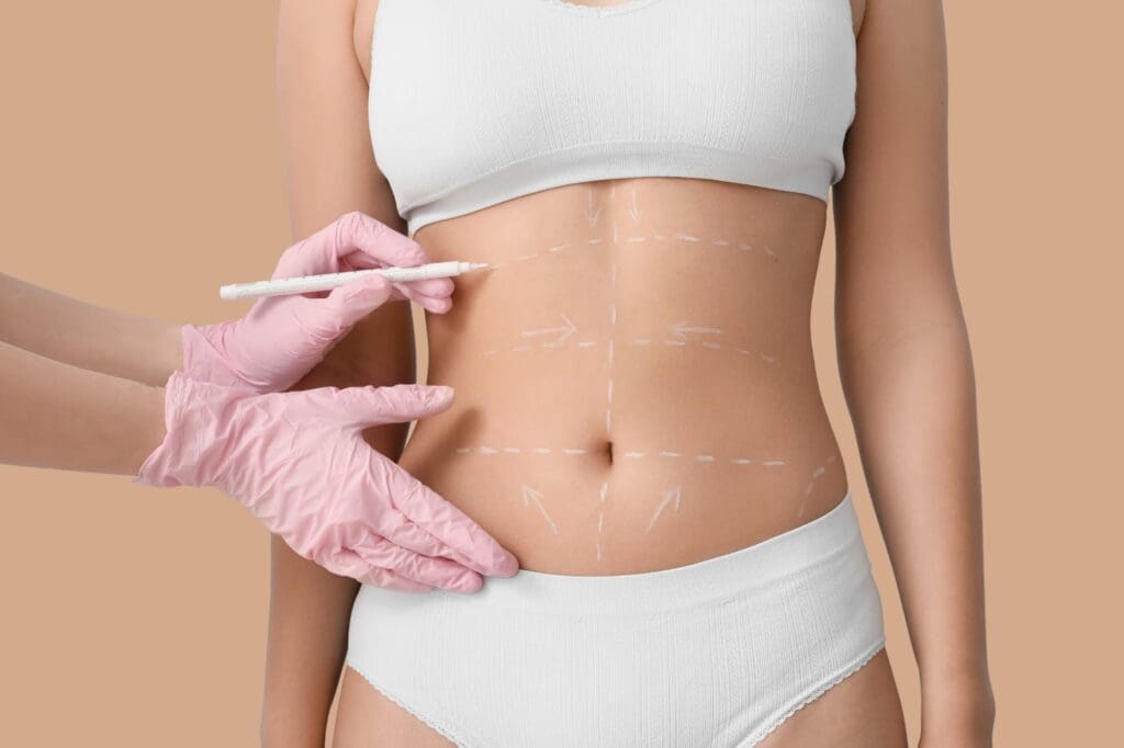 Quintessa tailors your liposuction procedure to your unique beauty goals and expectations for the best results.
