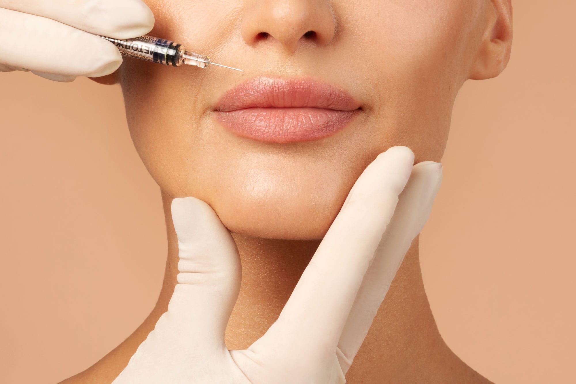 woman getting dermal filler in her lips