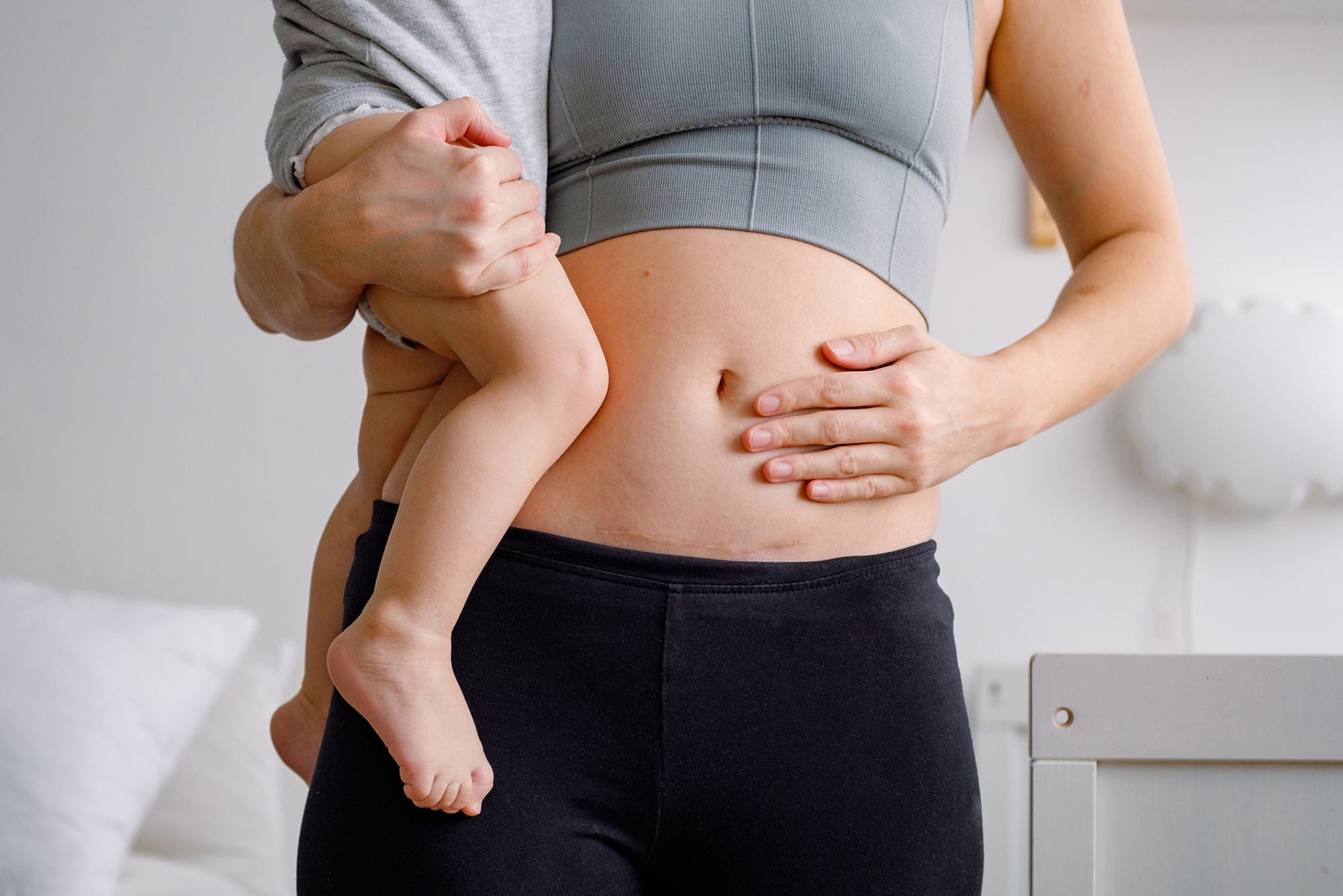 woman holding her baby before getting a mommy makeover after her c-section in Milwaukee, WI